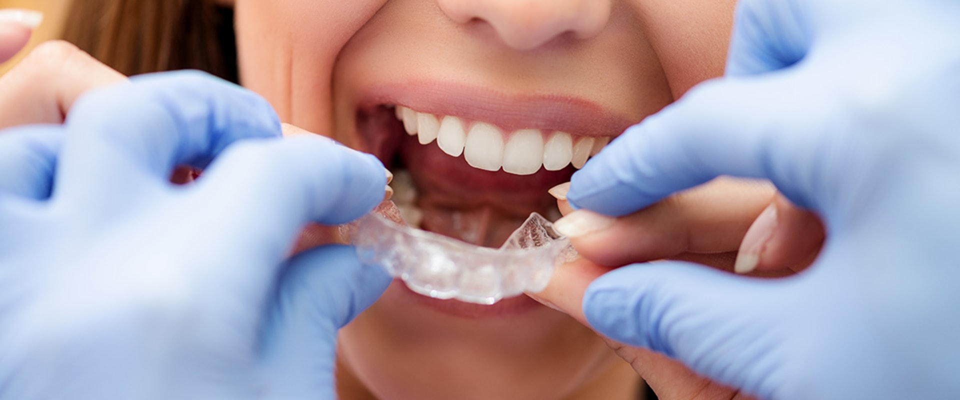Do Orthodontists Work on Gums?