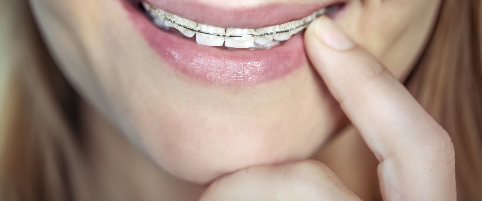 What is the Cost of Orthodontic Treatment in the UK?