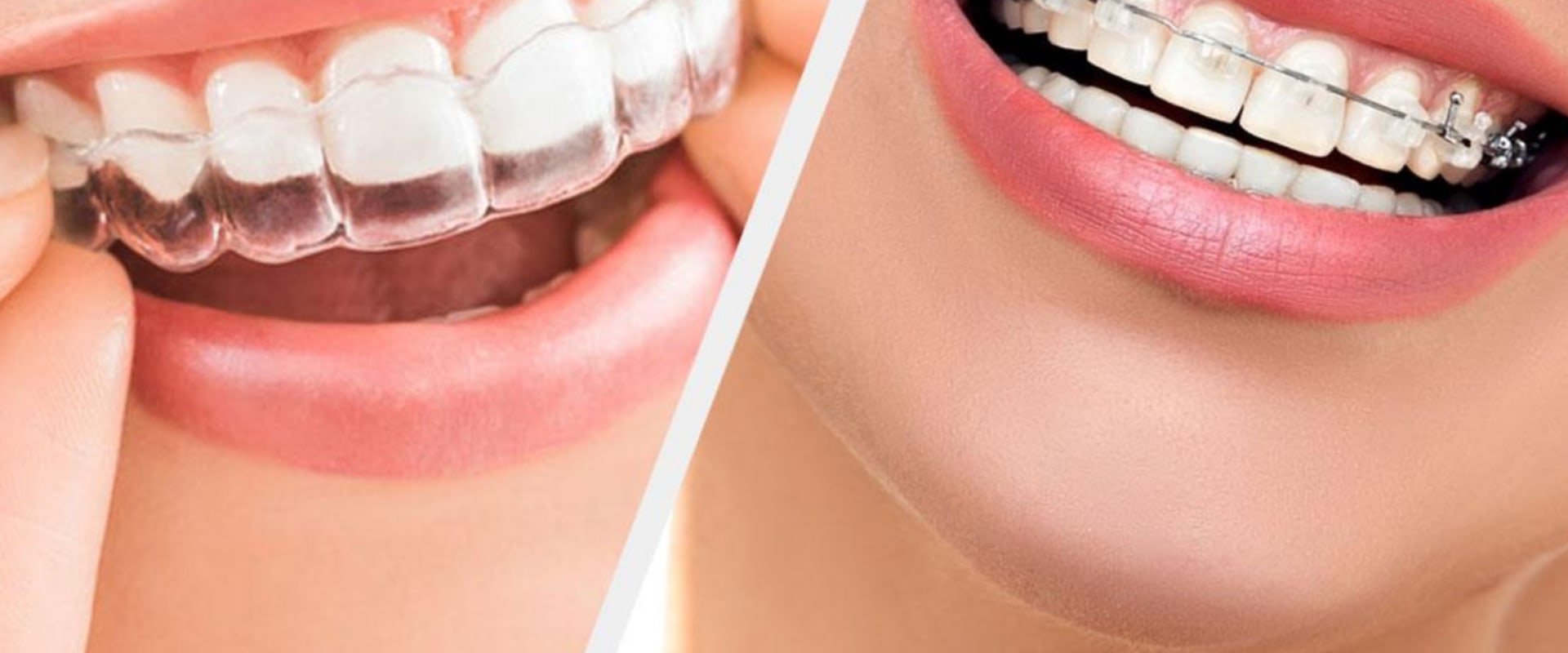 Specialised Treatments for Adults with Jaw Problems from a UK Orthodontist