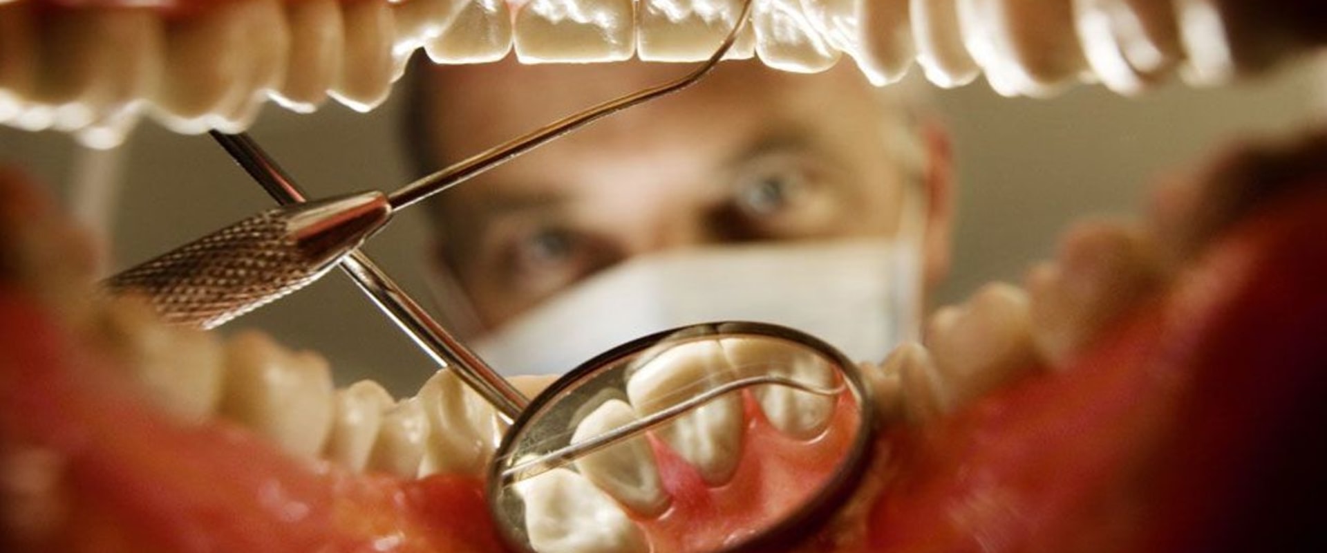 Do I Need to Have My Teeth Cleaned Before Seeing a UK Orthodontist?