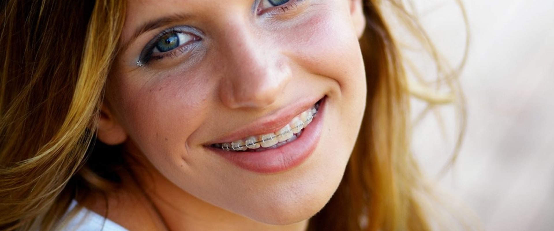 Aftercare for Orthodontic Treatment in the UK