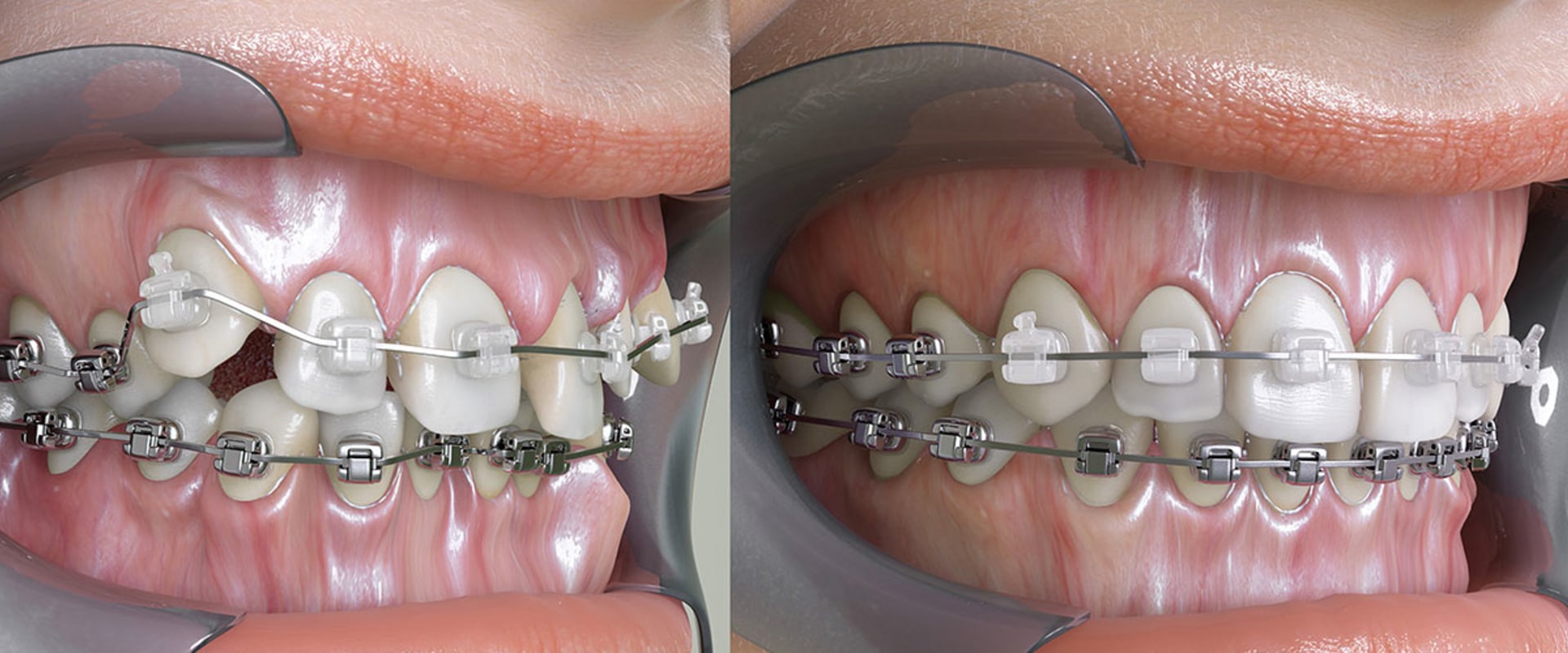 Can Orthodontists Help with Jaw Problems?