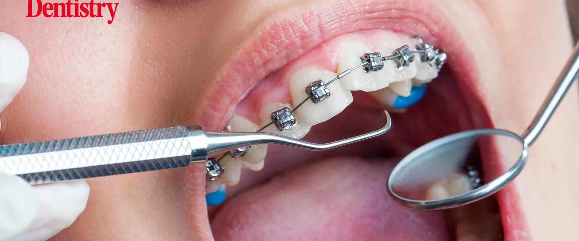 What Orthodontic Treatments Do UK Orthodontists Provide?