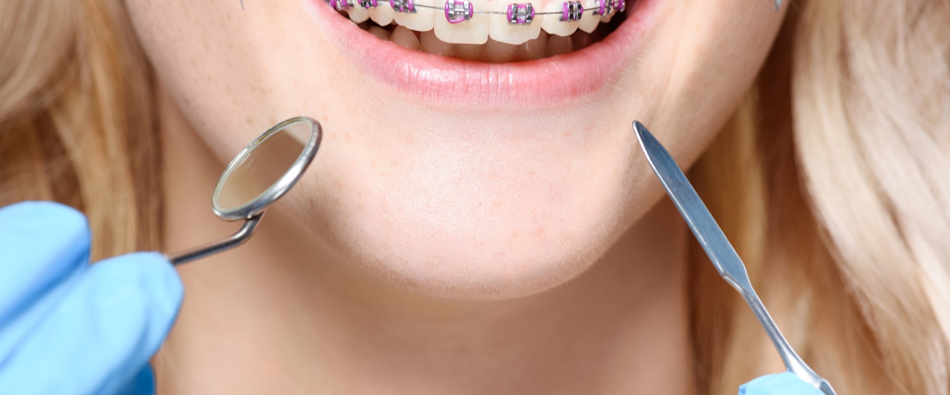 Do Orthodontists Exist in the UK?