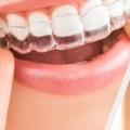 Specialised Treatments for Adults with Jaw Problems from a UK Orthodontist
