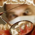 Do I Need to Have My Teeth Cleaned Before Seeing a UK Orthodontist?