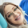 How Long Does it Take for an Orthodontist to Put on Braces?
