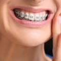 Do Orthodontists Treat Gums?