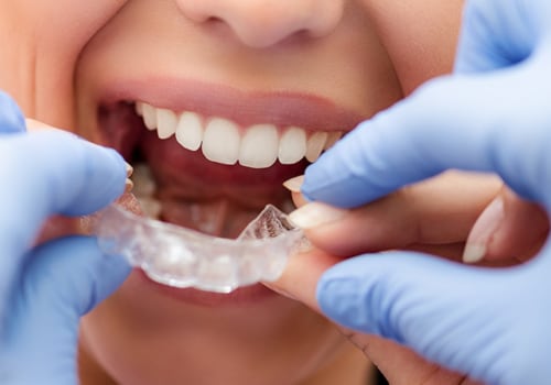 Do Orthodontists Work on Gums?