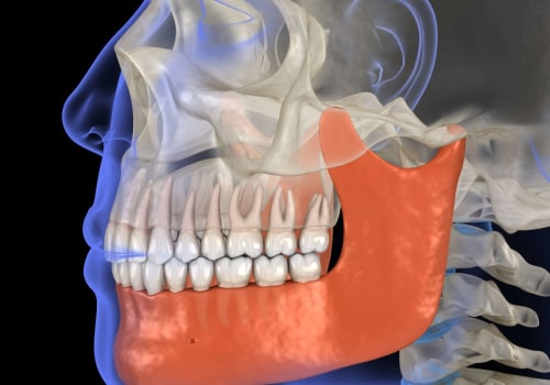 Can Orthodontists Help with TMJ Pain?