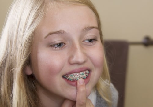 How Long is the Orthodontist Waiting List in the UK?