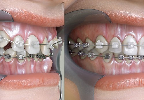Can Orthodontists Help with Jaw Problems?
