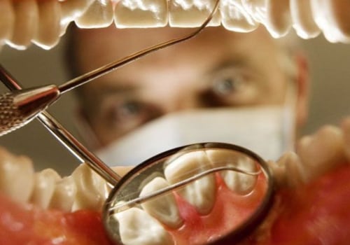 How Often Should I Visit My UK Orthodontist for Check-Ups?