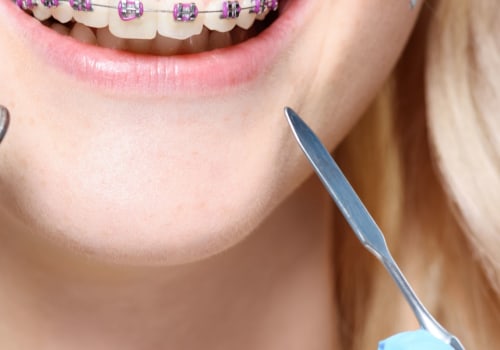 How Much Does it Cost to See an Orthodontist in the UK?