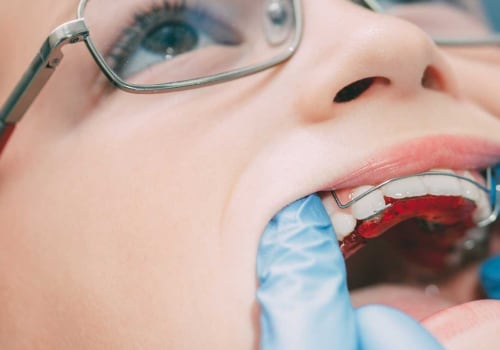 How Long Does It Take to Become an Orthodontist in the UK?